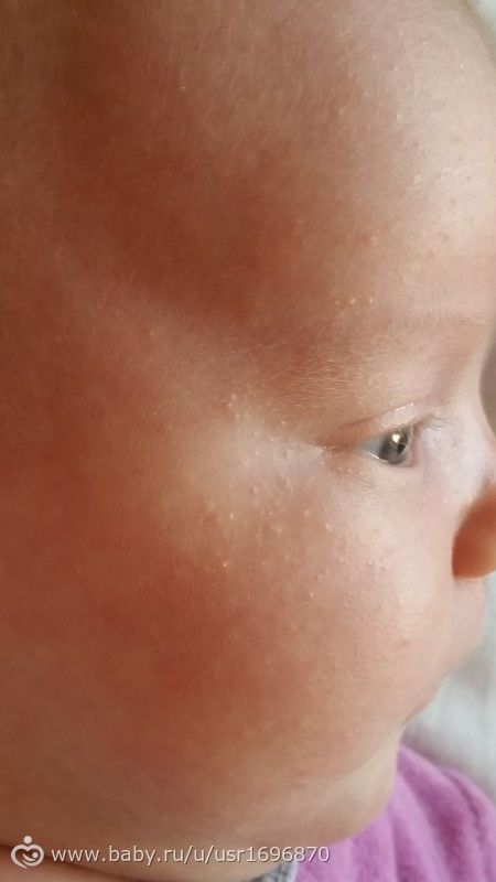 Как сделать ресницы длинными и густыми в домашних условиях? Как сделать кудри на короткие волосы фото и видео