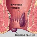 Когда солнце опасно для кожи Когда солнце опасно для кожи