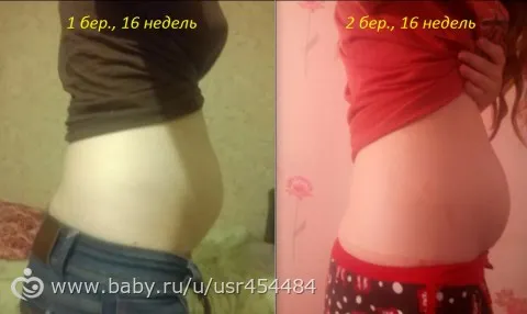 15 неделя беременности тянет живот