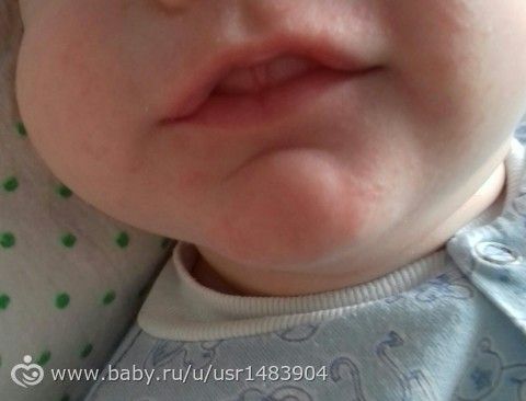 Лазерная коррекция зрения в Одессе Центр «Тарус» Комментарий к Федеральному закону от 21 ноября