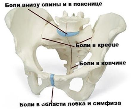 Боли в тазу и бедрах при беременности