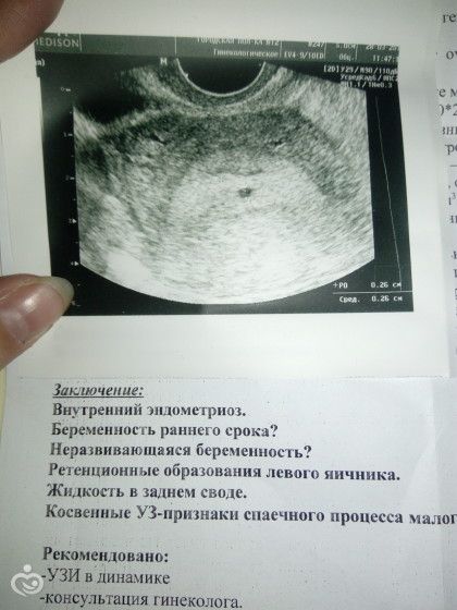39 Неделя беременности болят ребра 39 недель 27 неделя беременности: фото живота, УЗИ и вес