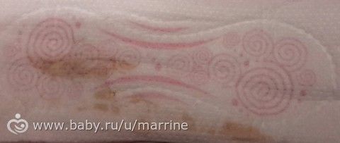 Выделения красно коричневые при беременности