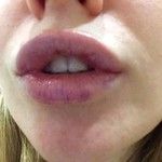 Как отмыть зелёнку с губы Как отмыть зелёнку с губы