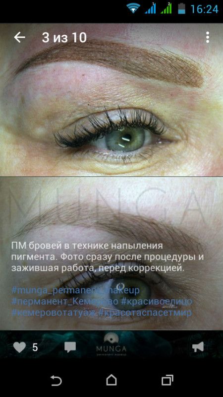 Противоотечные препараты при удалении зуба Противоотечные препараты при удалении зуба