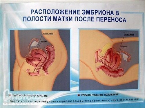Сколько по времени прикрепляется плод Сколько по времени прикрепляется плод