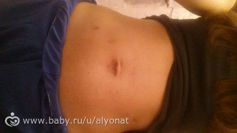 К чему снится синяк на животе беременной 62
