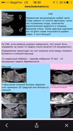 Пол на какой неделе можно. Как на УЗИ определяют пол ребенка. На каком сроке узнать пол ребенка по УЗИ. УЗИ пол ребенка на раннем сроке. Пол по УЗИ на ранних сроках.