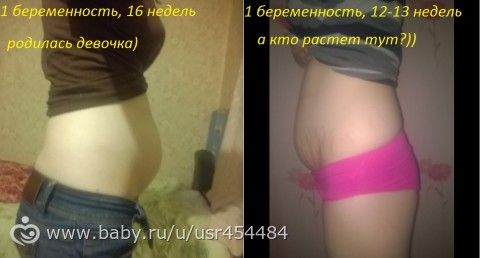 Вторая беременность, а разница на лицо)