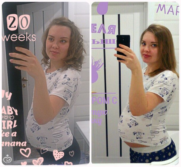 20 vs 26 недель фото)))