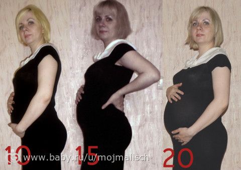 Двадцатинедельный пуз