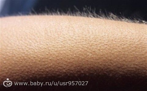 НЕприятны прикосновения