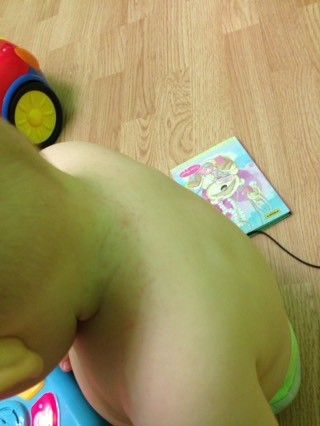 Аллергия или нет? Аллергия или нет?