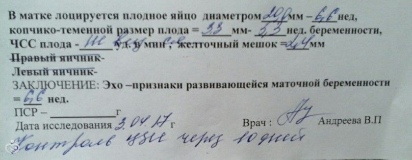 Узи