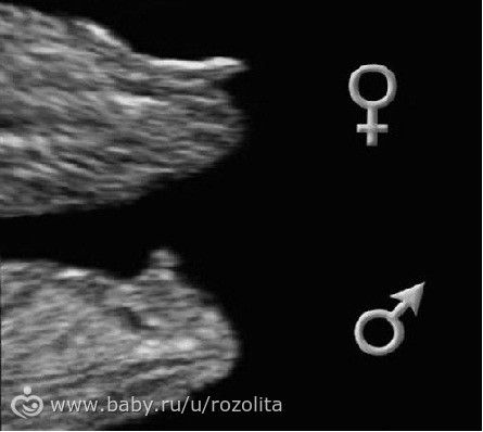 Мальчик или девочка? Разница полов на 12-13 неделе беременности (фото-сравнение узи)