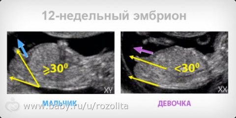 Мальчик или девочка? Разница полов на 12-13 неделе беременности (фото-сравнение узи)