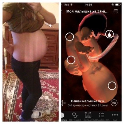 Ура 37😍😍😍😍неделю вылежали осталось Ура 37😍😍😍😍неделю вылежали осталось