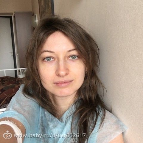 Гистероскопия под наркозом Самара