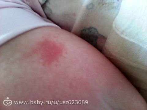Пятно на спинке