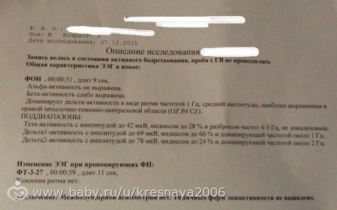 Результат ЭЭГ