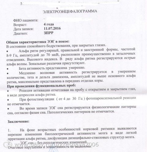 Результат ЭЭГ