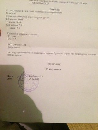 Доплер Доплер