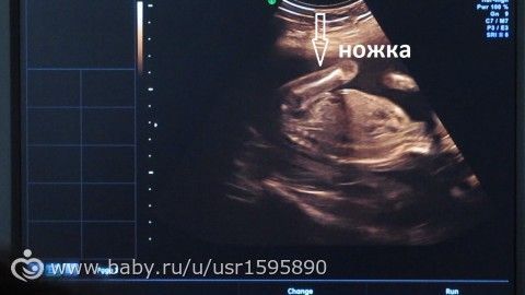 Девочка?