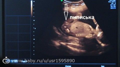 Видео с яндекс видео иванов