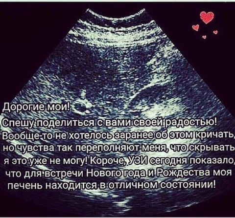 УЗИ УЗИ