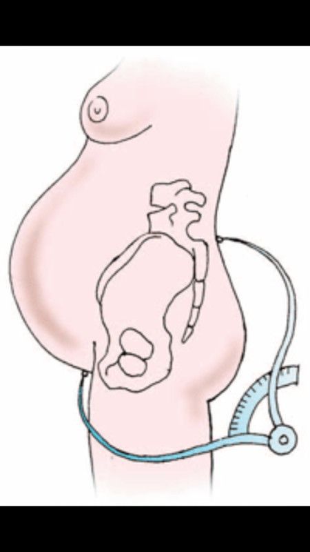 акушерская пельвиометрия