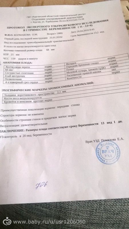 прошла 1 скрининг....жду помощи
