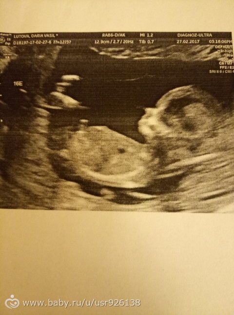 Наши новости с УЗИ ☺👶💙
