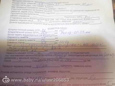 УЗИ 11 НЕДЕЛЬ