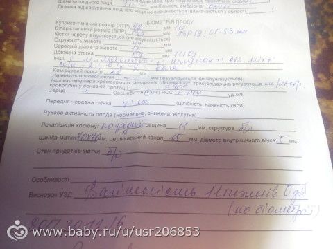 УЗИ 11 НЕДЕЛЬ